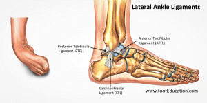 Ligaments damaged in a rolled ankle